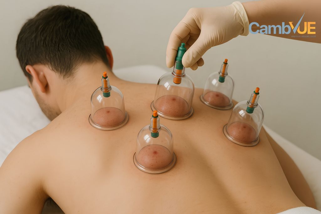 Diploma in Hijama Therapy (Cupping Therapy)